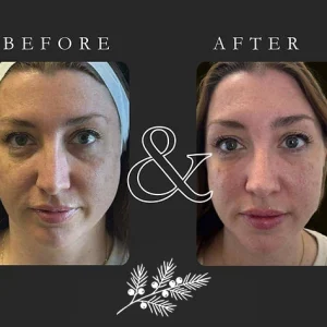 Juniper Reign - Before & After