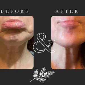 Juniper Reign - Before & After