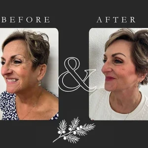 Juniper Reign - Before & After