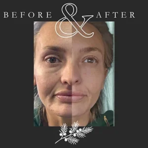 Juniper Reign - Before & After