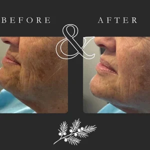 Juniper Reign - Before & After